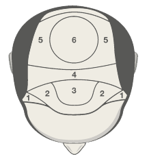 Scalp Zones Top