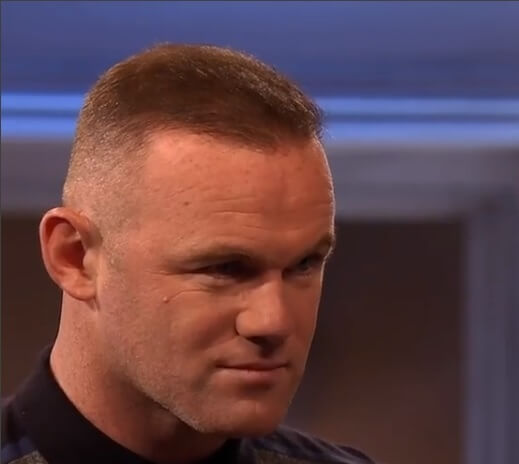 Nach der Haartransplantation – Rooney