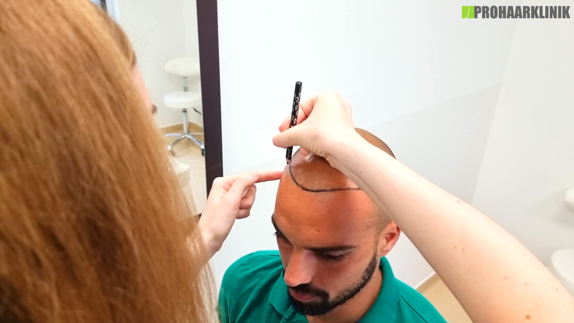 Warum ist die Planung der Haarlinie bei einer Haartransplantation so wichtig? - PROHAARKLINIK nahe Wien