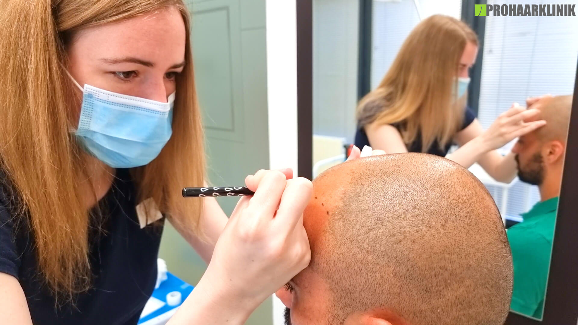 Warum ist die Planung der Haarlinie bei einer Haartransplantation so wichtig? - PROHAARKLINIK nahe Wien